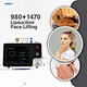 face lifting laser system